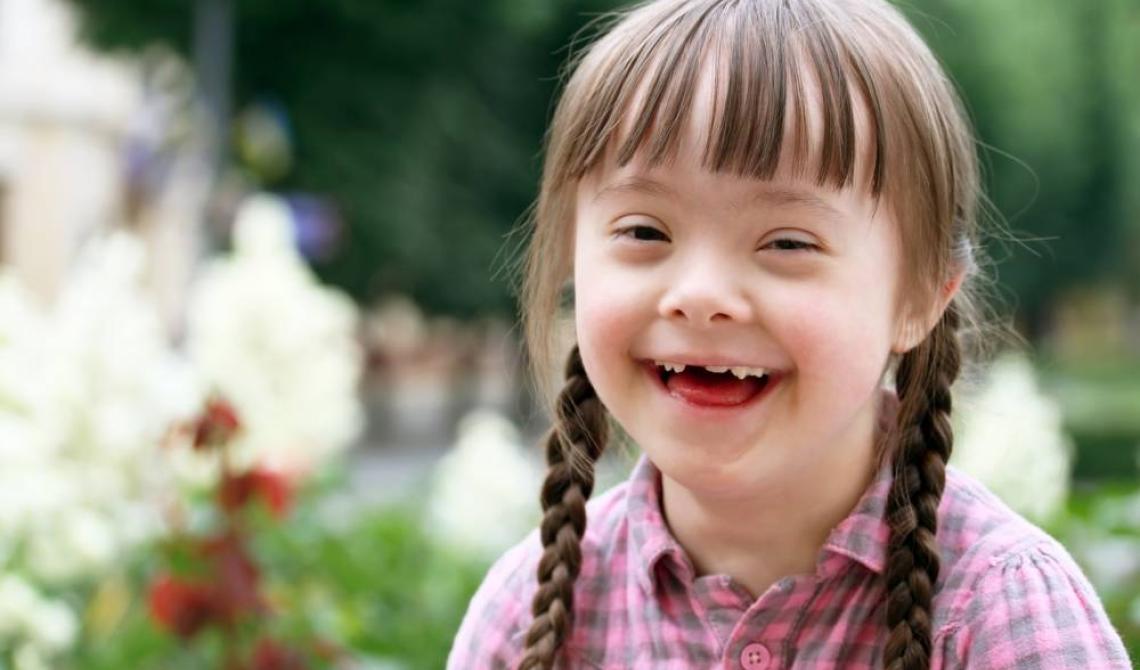 Per una società educata e consapevole sulla sindrome di Down: celebriamo inclusione e diversità